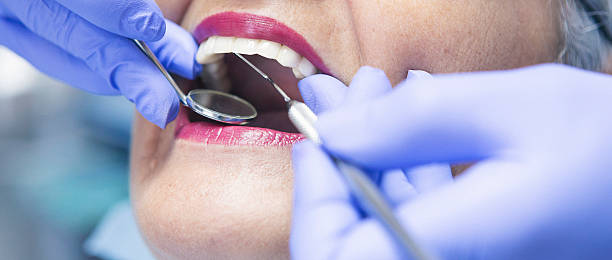 Best Broken or Chipped Tooth Repair in Sa De Oro Mount Helix, CA